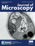 Journal Of Microscopy