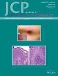 Journal Of Cutaneous Pathology