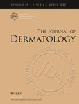 Journal Of Dermatology