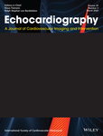 Echocardiography-a Journal Of Cardiovascular Ultrasound And Allied Techniques