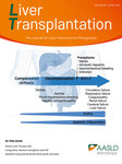 Liver Transplantation